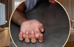 Người đàn ông chết do 'mây mưa' với nhân tình, vợ kiện 'tiểu tam' đòi bồi thường