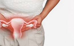 Người phụ nữ 35 tuổi bị tổn thương não, nguyên nhân bất ngờ từ nhiễm trùng phụ khoa