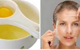 Công dụng không ngờ tới từ cách trị mụn cám bằng trứng gà