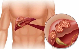 Thông tin cần biết về biến chứng gan ở người tiểu đường
