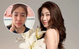 Từng bị trầm cảm la hét và tự cào cấu vào tay, ca sĩ Pha Lê sức khỏe hiện tại ra sao?