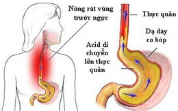 Nuốt nghẹn nghĩ chỉ viêm thực quản, người phụ nữ 54 tuổi ở Hà Nội đi khám phát hiện mắc cùng lúc 6 bệnh