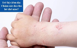 Trẻ bị viêm da: Chăm sóc da cho bé thế nào?