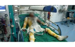 Nhức nhối ở làng nghề Tống Xá - Ninh Bình: Sức khỏe công nhân bị đe dọa, chính quyền xã nói 'chưa nhận được báo cáo'