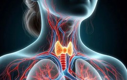 Người bị u tuyến giáp nên dừng ngay những nhóm thực phẩm này trước khi quá muộn
