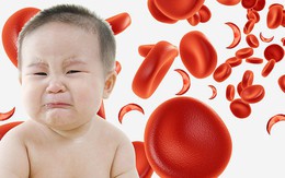 5 triệu chứng cảnh báo thiếu sắt ở trẻ em cha mẹ dễ bỏ qua và cách bổ sung an toàn