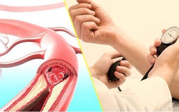 Người đàn ông tăng huyết áp đột ngột vì 1 lý do không ngờ tới