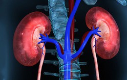 Thanh niên 26 tuổi suy thận phải chạy thận, không tin mình mắc bệnh vì vẫn thấy cơ thể bình thường