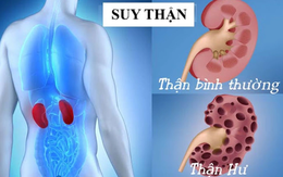 6 nguyên nhân âm thầm gây suy thận, phá hủy chức năng thận của bạn
