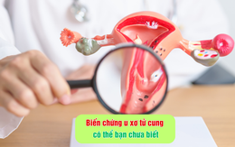 Biến chứng u xơ tử cung có thể bạn chưa biết