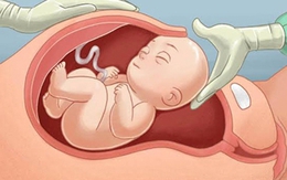 Yếu tố hình thành nhau cài răng lược - mối nguy hiểm trong thai kỳ