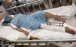 MS 1059: Cảnh khốn cùng của cô gái dân tộc Mảng bị tai nạn giao thông cần sự trợ giúp của cộng đồng