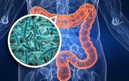 Không có triệu chứng tiêu hóa điển hình, nam kỹ sư bất ngờ phát hiện ung thư đại trực tràng từ dấu hiệu nhiều người Việt mắc phải