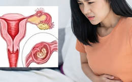 Dấu hiệu mang thai ngoài tử cung cần nhận biết sớm