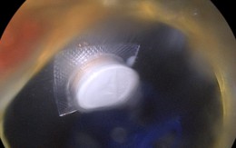 Uống thuốc giảm đau vai gáy, người đàn ông nhập viện gấp vì một sai sót nhiều người Việt mắc phải