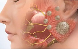 Người phụ nữ 38 tuổi âm thầm một mình chiến đấu với ung thư, thừa nhận 1 sai lầm nhiều người Việt mắc phải