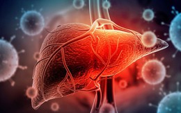 Sau Tết, người có dấu hiệu này chứng tỏ gan đang quá tải, nên kiểm tra men gan sớm