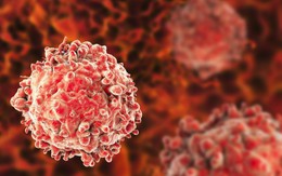 Người đàn ông 65 tuổi phát hiện ung thư dương vật từ dấu hiệu nhiều nam giới Việt bỏ qua