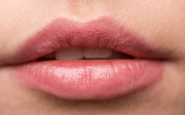 3 bí quyết trị thâm và khôi phục sắc môi hồng tự nhiên