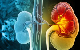 Loại củ quen thuộc đang bán nhiều ở chợ Việt, người bệnh suy thận cần lưu ý khi ăn để ngừa biến chứng