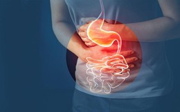 5 kiểu ăn uống âm thầm nuôi ung thư dạ dày, nhiều người vẫn lặp lại mỗi ngày