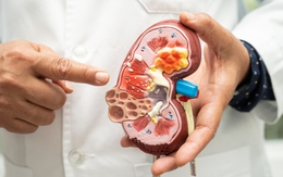 Người bệnh suy thận ăn hạnh nhân thế nào để tốt nhất?