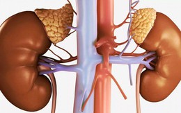 Người phụ nữ 39 tuổi bất ngờ phát hiện u tuyến thượng thận từ dấu hiệu nhiều người Việt bỏ qua