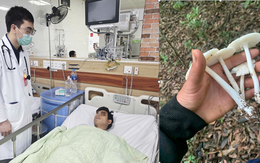 Nhiều người viêm gan, suy gan cấp, suy đa tạng nguy kịch vì sai lầm khi ăn nấm tự hái