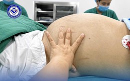 Thiếu nữ 19 tuổi mang khối u buồng trứng khoảng 30cm vì tâm lý chủ quan phụ nữ Việt hay mắc phải