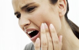 Người đàn ông 39 tuổi tiêu xương hàm, mất răng vì không nhổ răng khôn mọc lệch