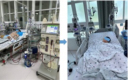 Từ cơn cảm sốt nhẹ, bé trai 11 tuổi viêm cơ tim nguy kịch: Bác sĩ cảnh báo sai lầm nhiều phụ huynh mắc phải
