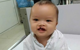 MS 1099: Bé trai 8 tháng tuổi bị bỏ rơi trước cổng chùa cần trợ giúp để phẫu thuật dị tật