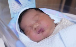 Sinh con nặng 5,3 kg do tiểu đường thai kỳ, bác sĩ khuyến cáo thai phụ làm điều này để con khỏe mạnh
