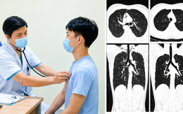 Nam thanh niên 20 tuổi tràn khí trung thất sau 1 tuần ho liên tục, bác sĩ cảnh báo dấu hiệu dễ bị bỏ qua