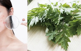 Cách trị mụn bằng ngải cứu hiệu quả an toàn không để lại vết thâm