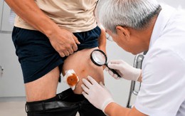 Người đàn ông Hà Nội phát hiện ấu trùng sán nhái dài 7cm ở đùi từ nguyên nhân không ngờ