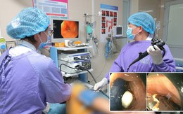 Nuốt nguyên viên thuốc còn vỏ, người đàn ông 60 tuổi phải cấp cứu vì dị vật mắc ở thực quản