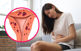 Người phụ nữ 39 tuổi phát hiện tử cung to như mang thai 3 tháng từ dấu hiệu nhiều chị em Việt bỏ qua
