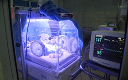 Giành giật sự sống từng giờ cho cháu bé bị vứt bên đường ở Hạ Long