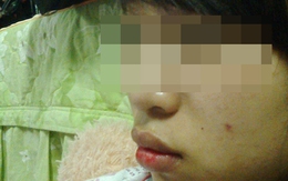 Nước mắt cô dâu lỡ đêm tân hôn vì chú rể đốt pháo... lấy oai trong tiệc cưới