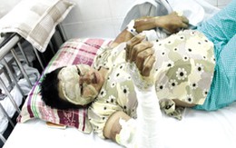 Nhẫn tâm đốt chị dâu và cháu ruột