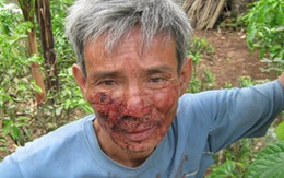 Bố say xỉn, con ra đòn