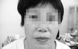 Cảnh báo: Hậu silicone lỏng
