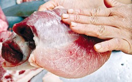 Thịt độc chủ yếu ở thành phố