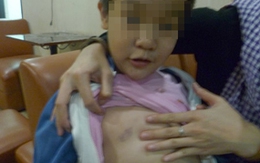 Cô đánh, lánh trường