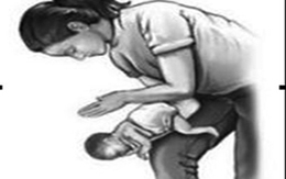 Sơ cứu đúng cách với dị vật đường thở