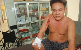 Truy tố ấp trưởng cầm đầu nhóm côn đồ chém người