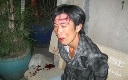 Cướp dùng súng cao su bắn trả "hiệp sĩ"