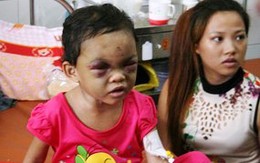 Nghi vấn bé 4 tuổi bị ngược đãi không phải con đẻ của người cha dã thú
