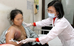 Kinh hoàng khối u khổng lồ thâm đen bị "nổ"